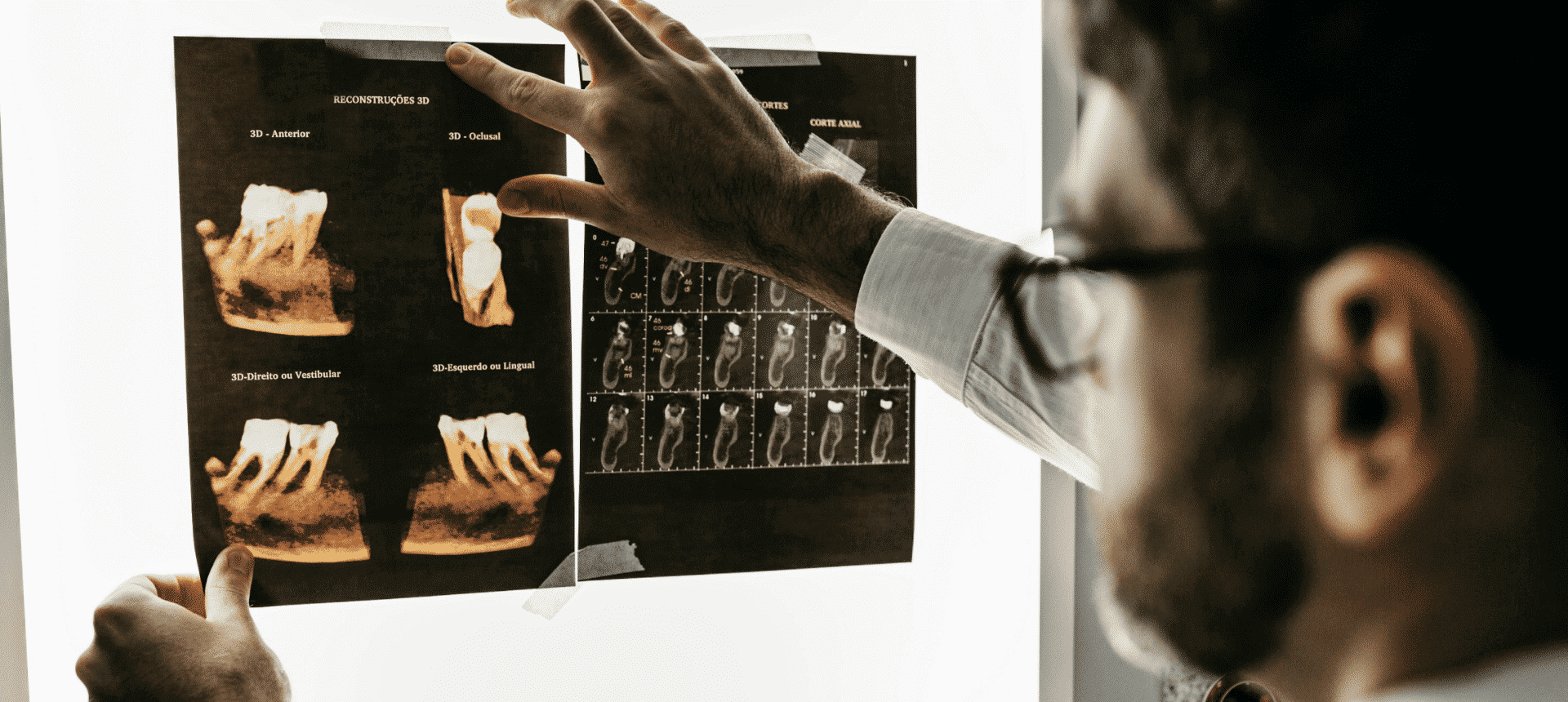 BEGO Implant Systems: Ein Beispiel aus der Praxis